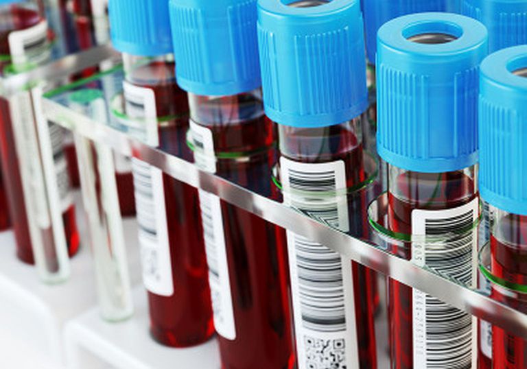 Laboratory Barcoding Reminder
